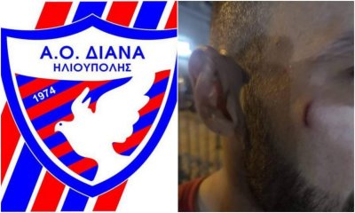 Άγνωστοι Μαχαίρωσαν Τον Τερματοφύλακα Της «Διάνα» Ηλιούπολης – Καταγγελία Από Την Ομάδα