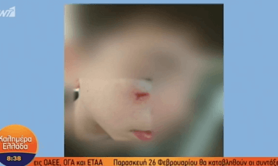 Καταγγελία Για Ξυλοδαρμό Μαθητή Σε Σχολείο Της Ηλιούπολης (VIDEO)